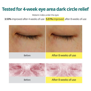 GOODAL Green Tangerine Vitamin C Eye Cream - Dark Circle Relief